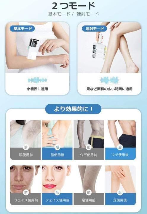 最新WPL機能搭載❣自宅で脱毛サロン級の安心安全な脱毛♪❤氷感IPL光脱毛器