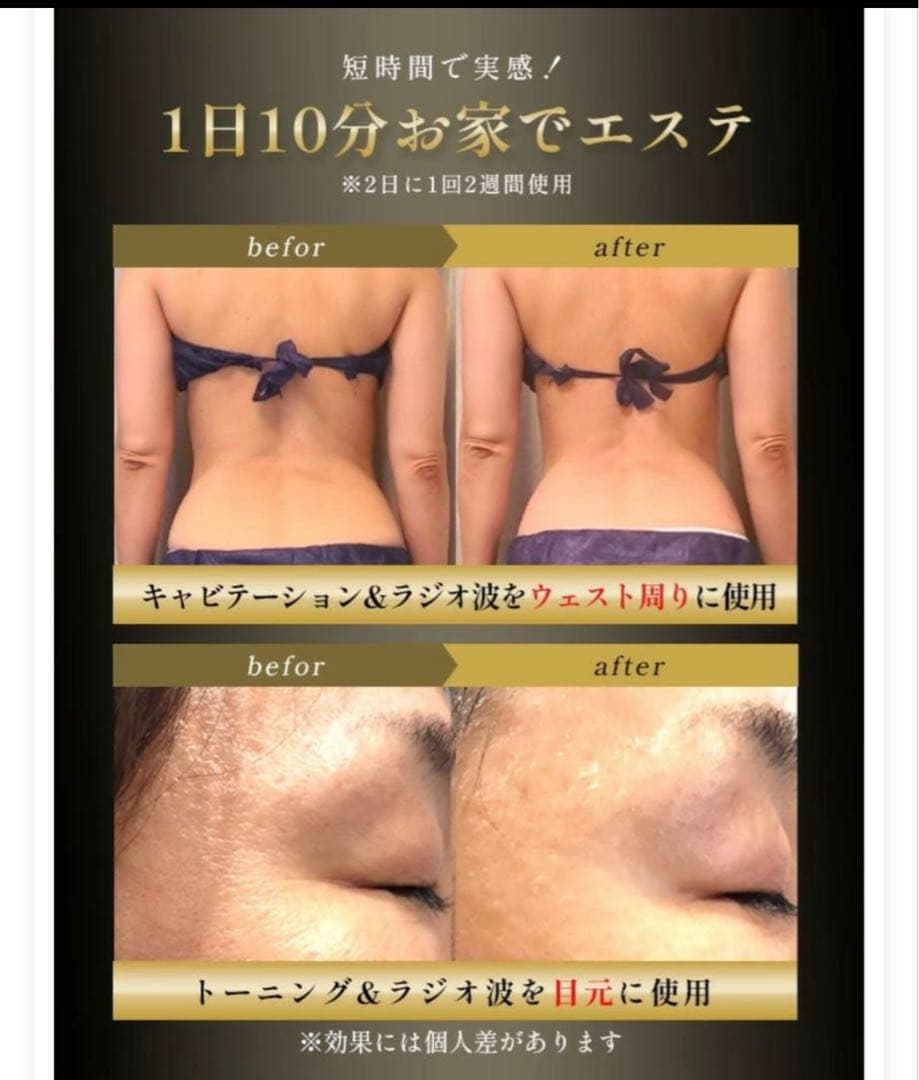 業務用キャビテーション複合機　ラジオ波　自宅用エステマシン　少し訳あり