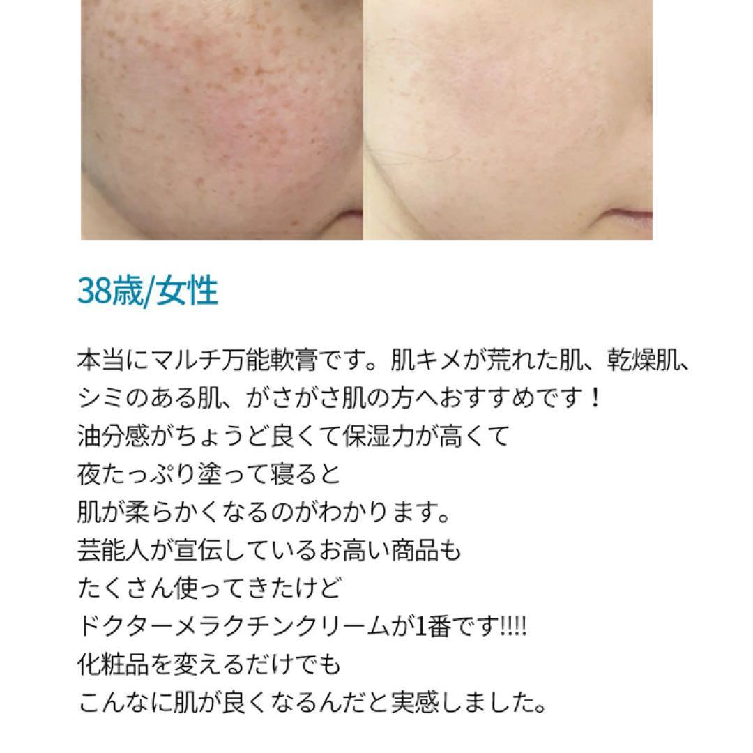 Dr.Melaxin TXアンプル＋TXクリームセット トラネキサム酸 美白ケア