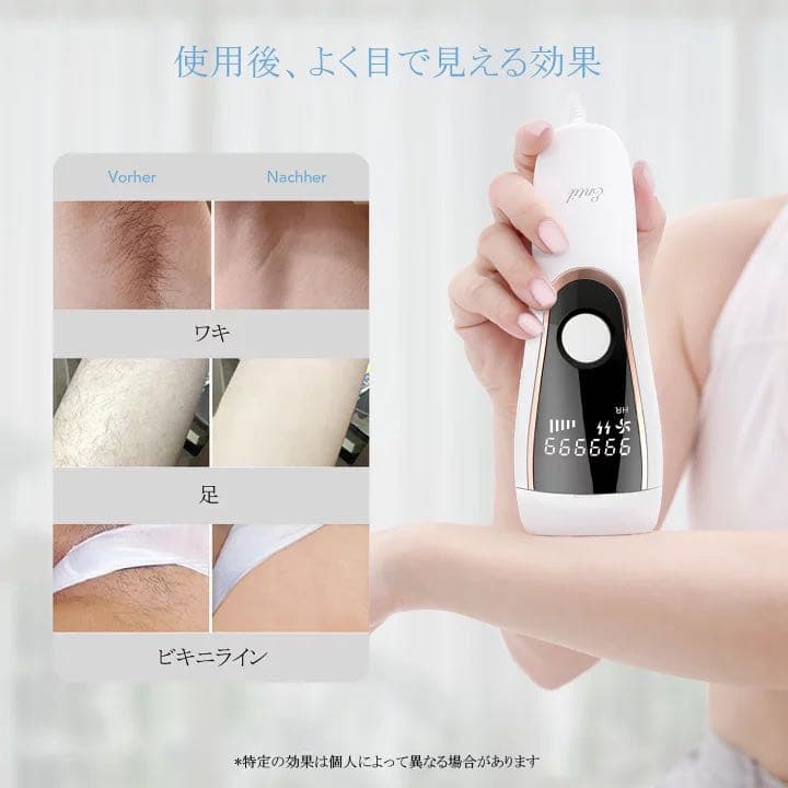 脱毛器IPLレーザ脱毛器 家庭用脱毛器 レディー メンズ 新品未使用 大人気