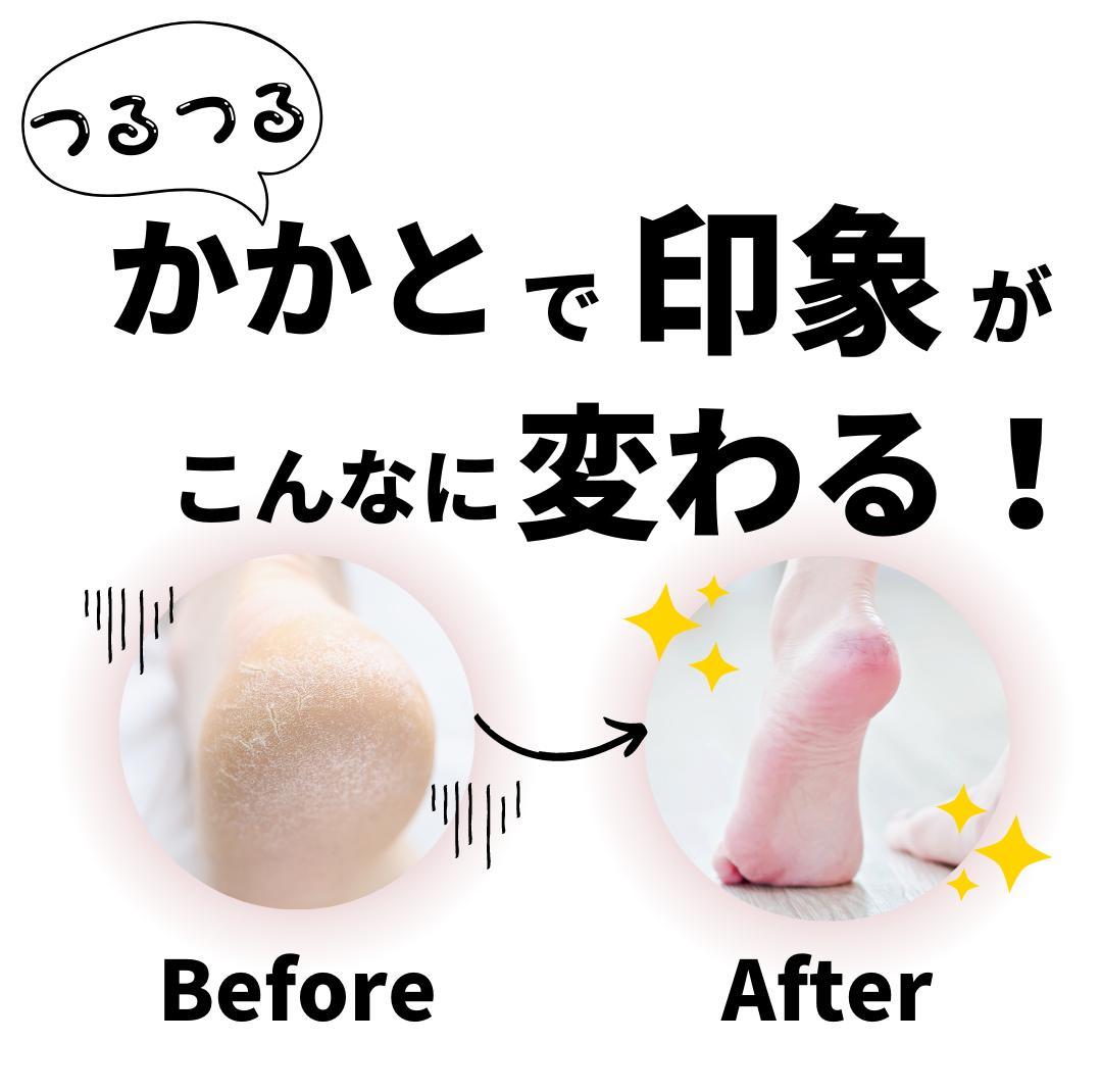 【10個セット】コウンバル 赤色 韓国人気NO1 かかとクリーム 転売可